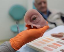 HR produz pelo SUS próteses faciais que recuperam autoestima dos pacientes