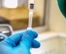 Em seis meses, Lacen processa 13.298 amostras de vírus respiratórios